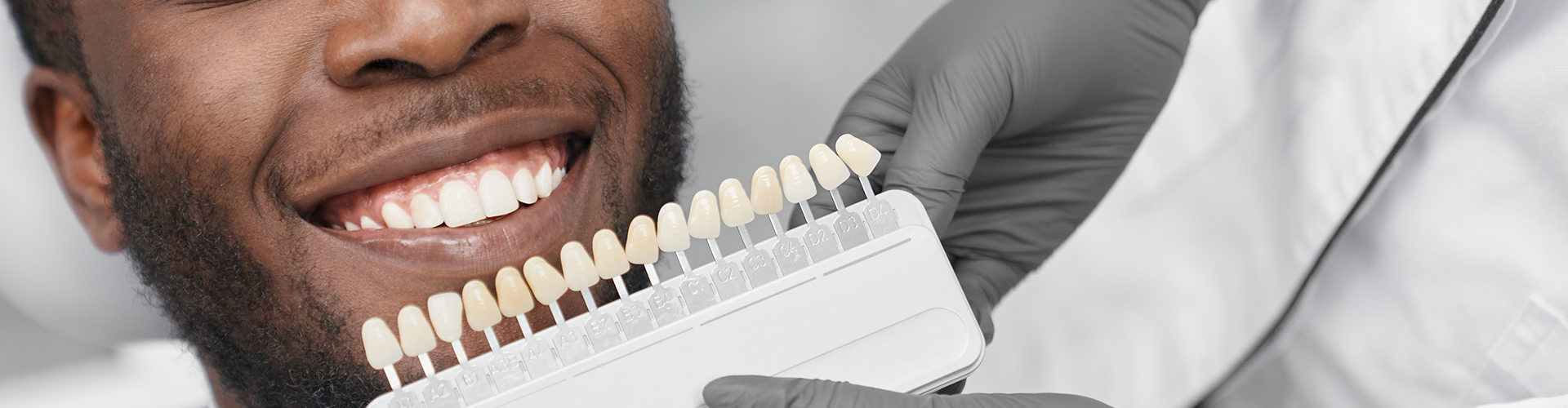 gloved hand holding tooth shade-matching tool against man's teeth
